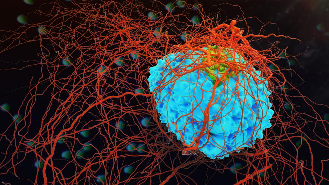 Nigeria lost $5.6bn to cancer in 2019 -Report