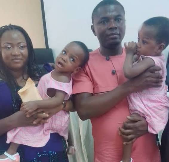 National Hospital discharges separated conjoined twins