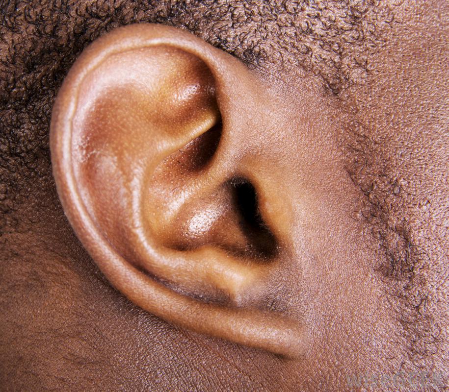 8.3m Nigerians suffering from hearing disorder, says SPAAN president