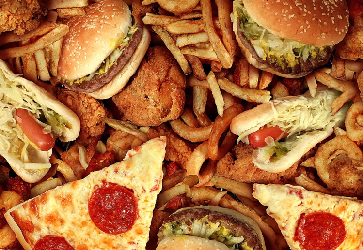 Avoid junk foods, unhealthy lifestyles for brain health –Experts