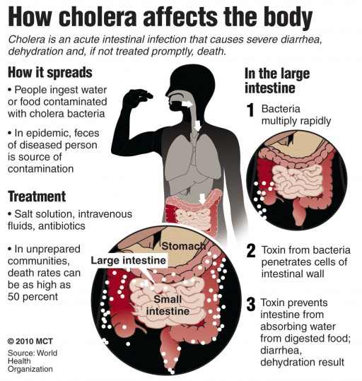 Cholera: 1bn people from Nigeria, 42 countries at risk –UN