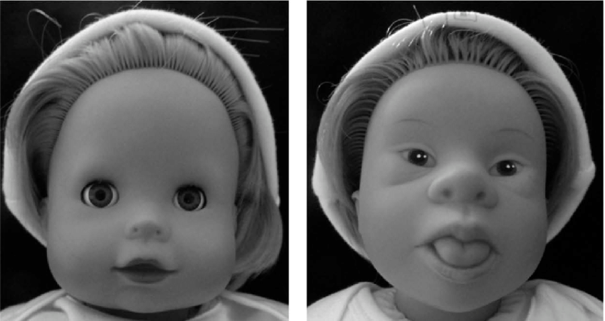 'Babies conceived by women above 35 years risk Down syndrome'