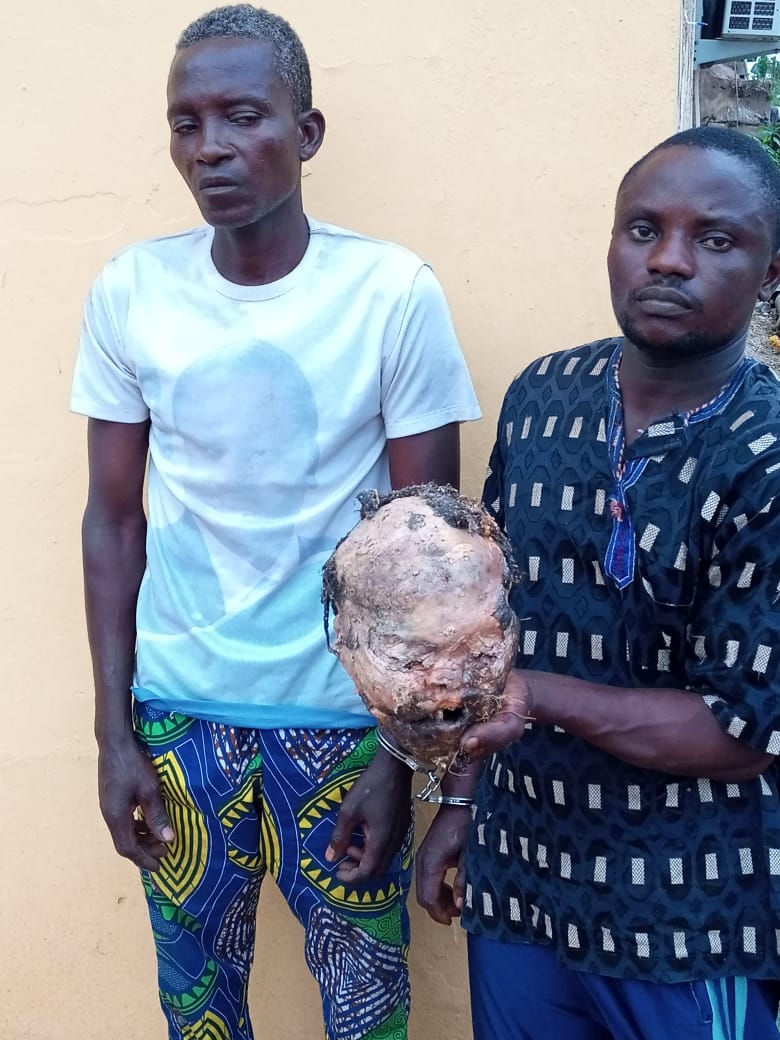 How we arrested two men in possession of human head –Police