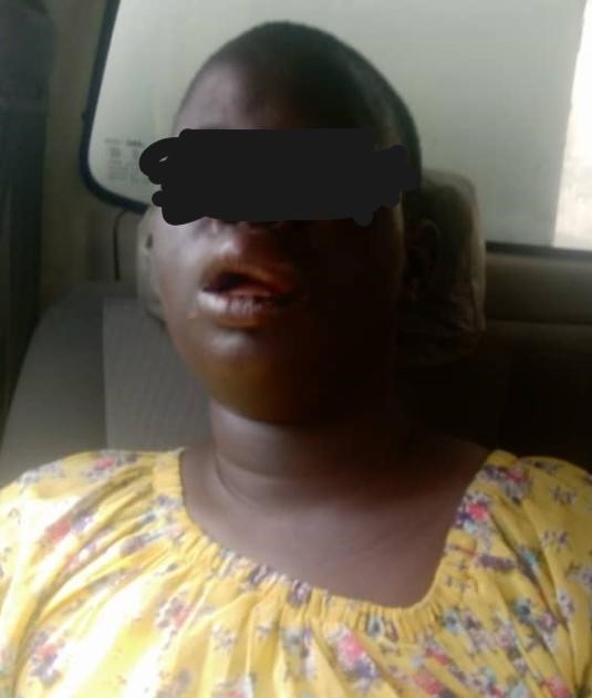 Suicide attempt: How we stopped lady from jumping into lagoon -RRS