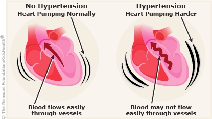 How healthy diet can lower hypertension -Physician