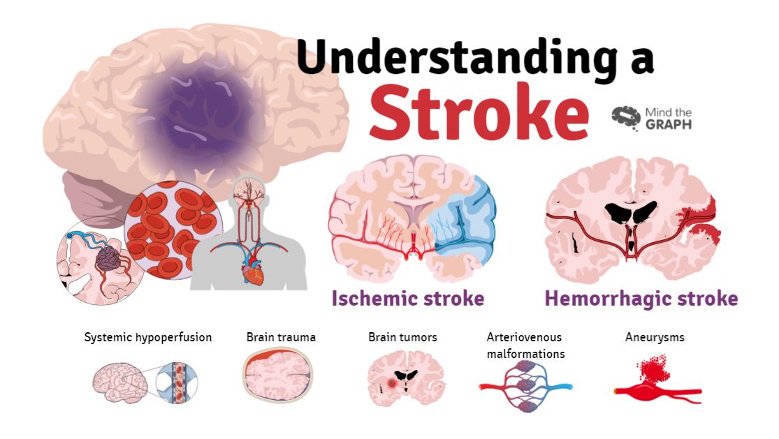 'Six indigenous Africans develop stroke every minute, every hour'