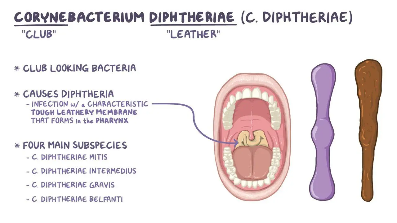 Lagos records six confirmed diphtheria cases