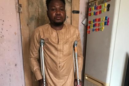 Man seeks financial assistance to repair broken leg