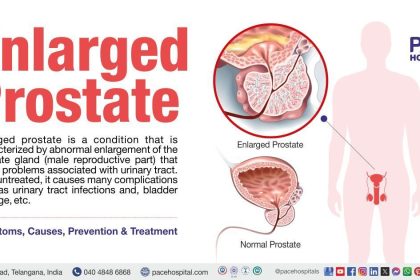 Prostate enlargement: Expert speaks on early detection, prevention