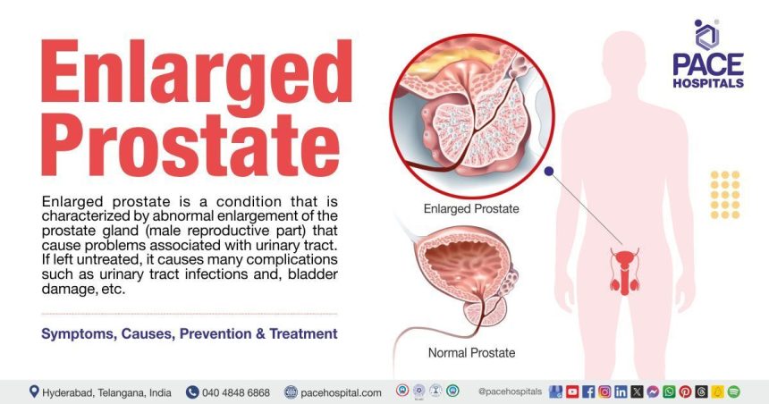 Prostate enlargement: Expert speaks on early detection, prevention