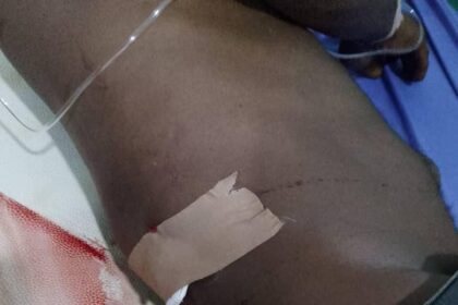 Three NDLEA officers shot in Abuja raid, hospitalized