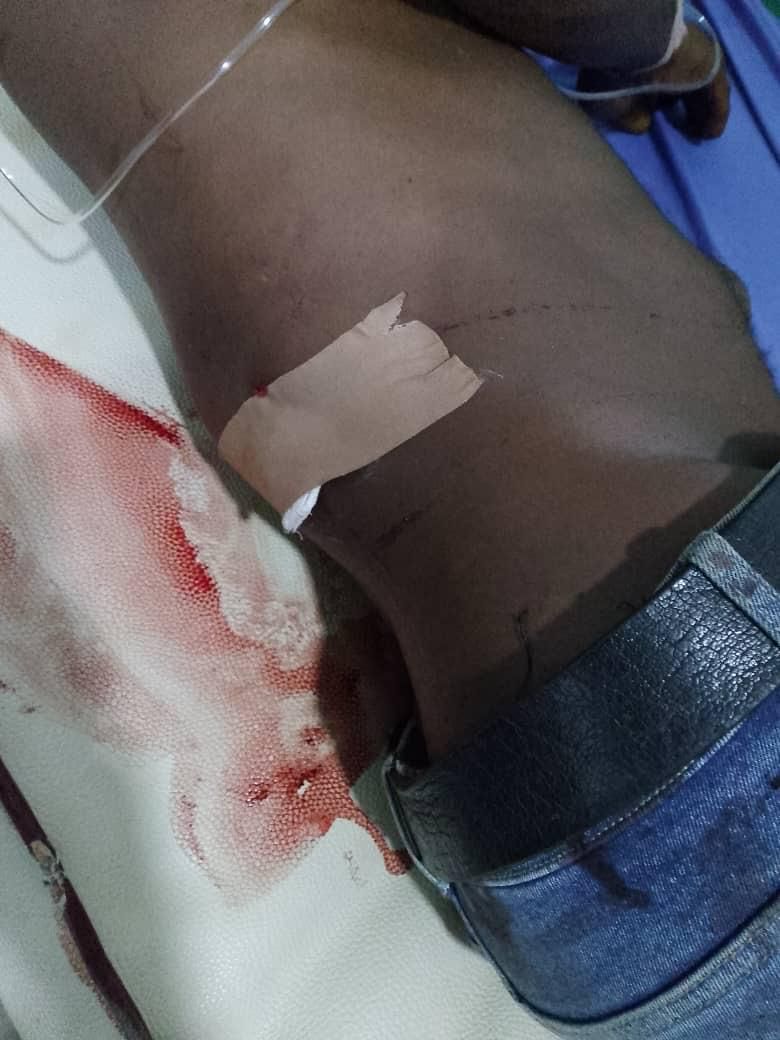 Three NDLEA officers shot in Abuja raid, hospitalized