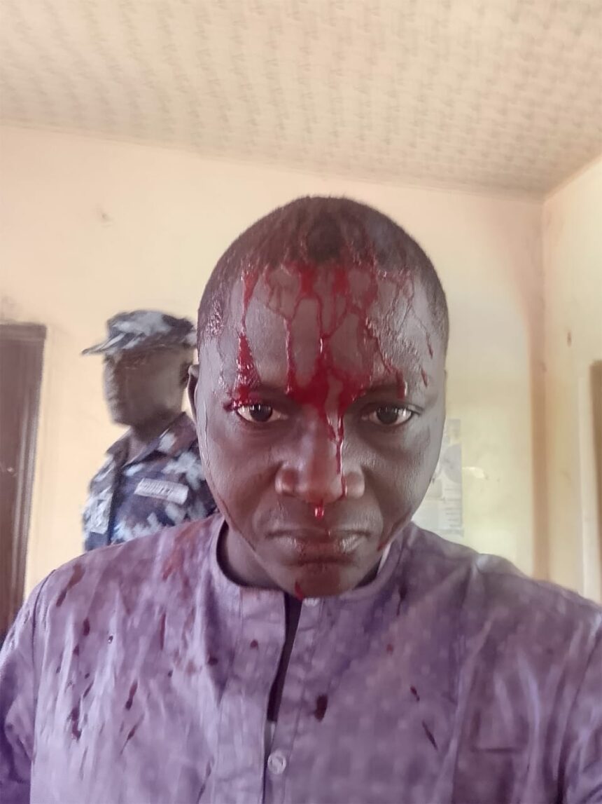 MRA condemns assault on journalist in Bauchi, calls for probe