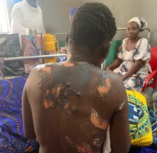 Police arrest man for allegedly setting wife ablaze