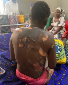 Police arrest man for allegedly setting wife ablaze