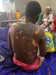 Police arrest man for allegedly setting wife ablaze