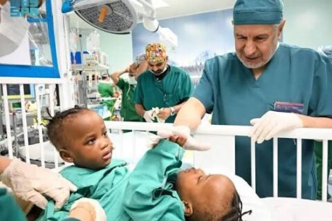 Saudi Arabia begins separation surgery for Tanzanian conjoined twins