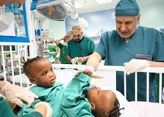 Saudi Arabia begins separation surgery for Tanzanian conjoined twins