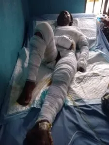Housewife burns husband’s mistress to death, arrested by police (+photos)