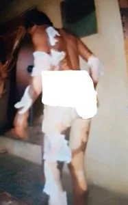 Man arrested for setting wife ablaze over food (+Photos)